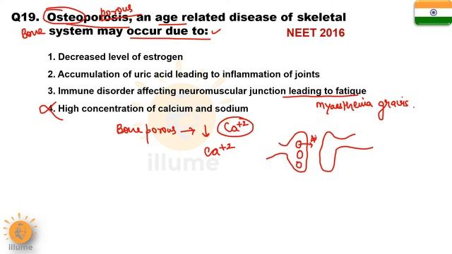 Illume Doubts 19 | Why Osteoporosis occurs after Menopause ? | Dr Ghanshyam Jangid смотреть онлайн