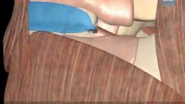 Миофункциональный трейнер схема смотреть онлайн