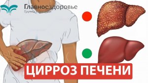 Цирроз печени. Экстренная помощь