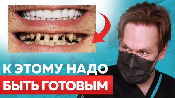 НЕ ставь ВИНИРЫ, пока не посмотришь это видео!