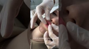 МАССАЖ ГУБ после процедуры увеличения | Лучшая техника от комочков