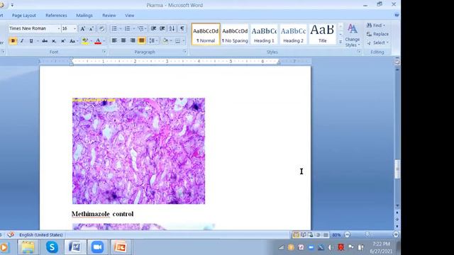 Research Methodology Workshop, Day-7-Dr. B. Ravishankar смотреть онлайн