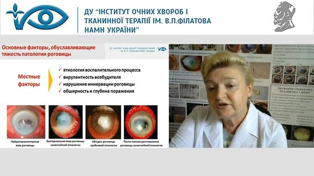 Основные направления работы отдела патологии роговицы  д.м.н., профессор Дрожжина Г.И. Часть 1