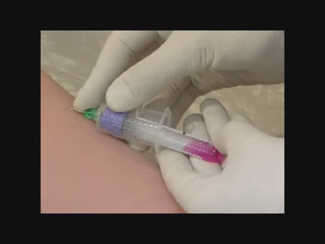 Забор крови из вены