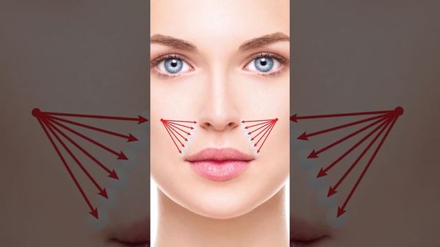 Коррекция носогубной складки филлером FEEL DERLI NORMAL