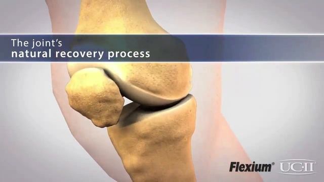 FLEXIUM UC-II Colágeno tipo II no desnaturalizado смотреть онлайн