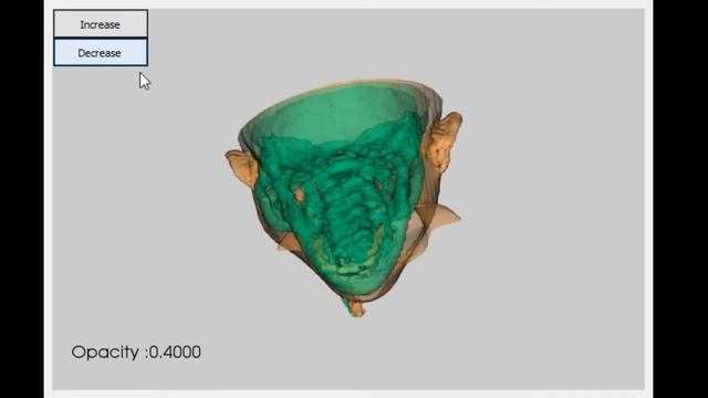 Head visualization VTK(python) смотреть онлайн