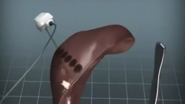 22  Мусульмане снова стали показывать пример в Медицине