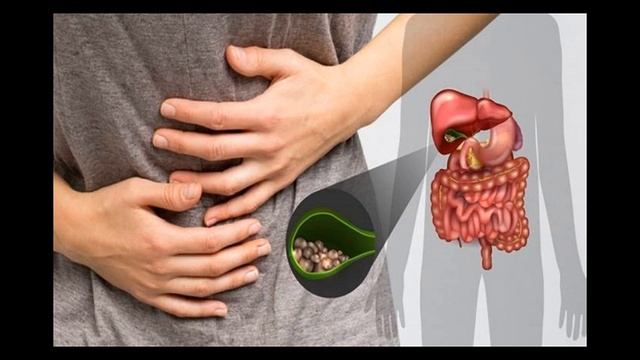 Чем опасна густая желчь и как распознать ее у себя? смотреть онлайн