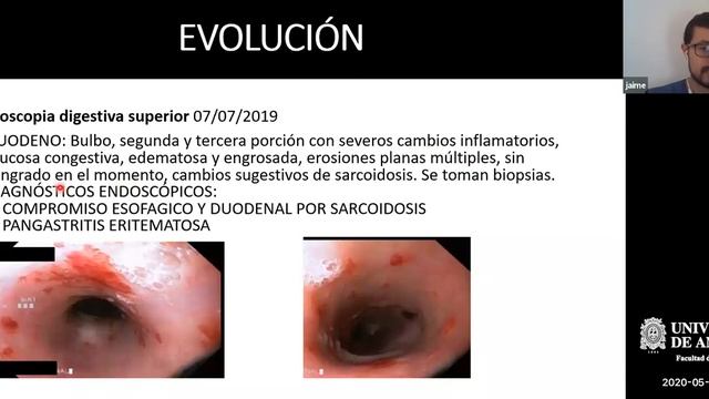 Ateneo Clínico - Dr. Jaime Alberto Gomez смотреть онлайн
