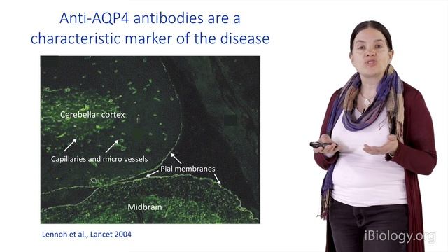 Bench to Bedside: Myelination 2 - Neuropathology of Multiple Sclerosis - Christine Stadelmann смотреть онлайн