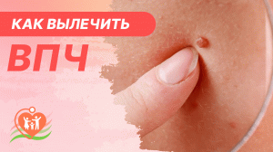 ? Вирус папилломы человека. Как вылечить ВПЧ?