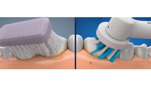 Ультразвуковая щетка - что это такое? смотреть онлайн