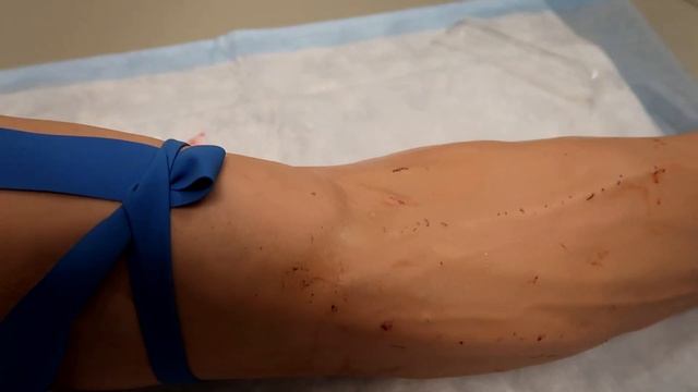 How To Start An I.V. | 68W (Combat Medic) AIT Skills Validation смотреть онлайн