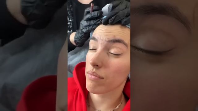 Теория ботулотоксин. Верхняя треть Анатомия мышц смотреть онлайн