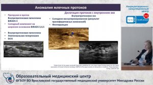 Избранные вопросы ультразвуковой диагностики заболеваний молочной железы.