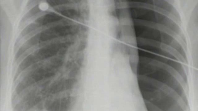 catheterization2.mp4 смотреть онлайн