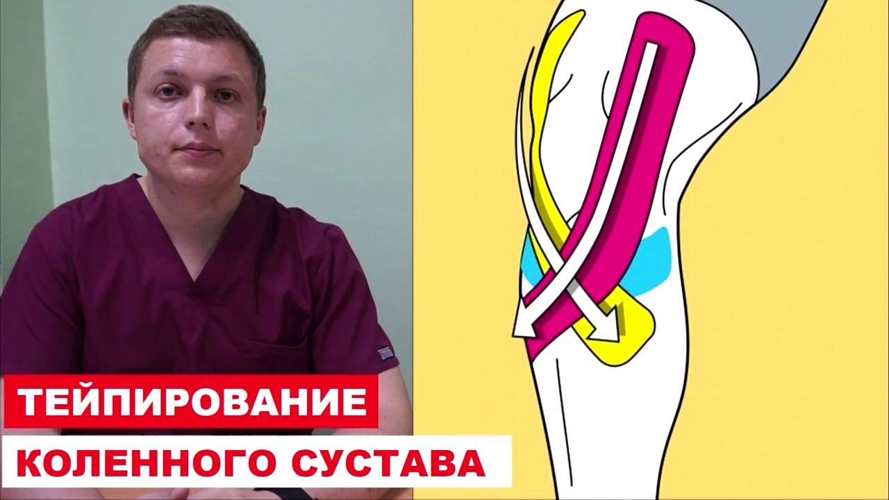 Боль в колене | Тейпирование коленного сустава: особенности применения тейп-лент 