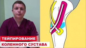 Боль в колене | Тейпирование коленного сустава: особенности применения тейп-лент