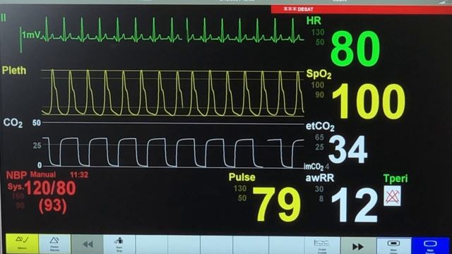 El monitor cardíaco y sus funciones Parte I смотреть онлайн
