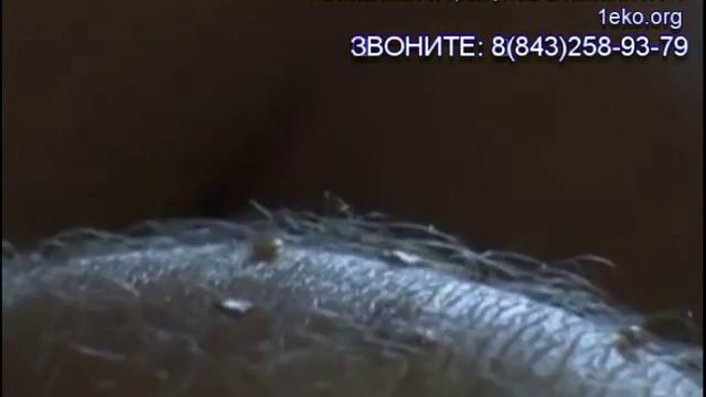 Как избавиться от клопов в квартире смотреть онлайн