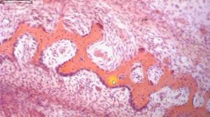 Прямой #остеогенез