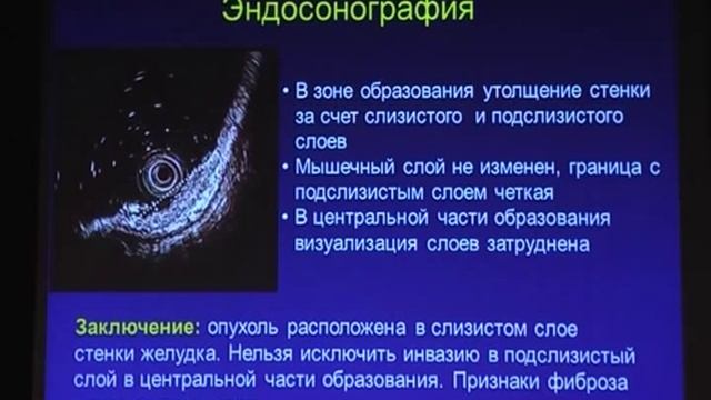 15 Куваев Р О Язва и рак желудка проблемы эндоскопической и гистологической диф диагностики смотреть онлайн