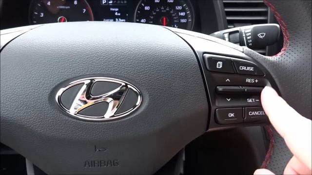 2017 Hyundai Elantra Sport 1.6T Start Up/ In-Depth Review смотреть онлайн