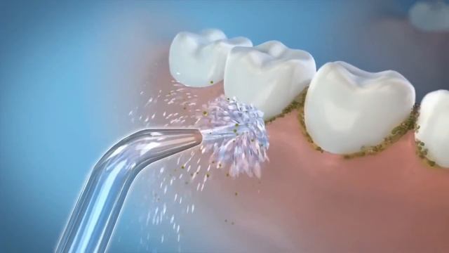 Обзор на ирригатор Waterpik WF-02 Cordless Express смотреть онлайн