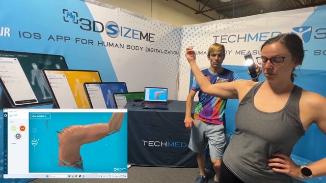 Elbow scanning with MSoft and the Einstar scanner смотреть онлайн