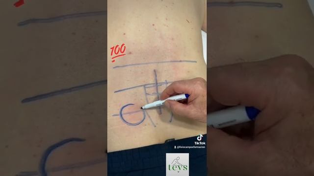 TEYS & DOLOR POST-CIRUGIA смотреть онлайн