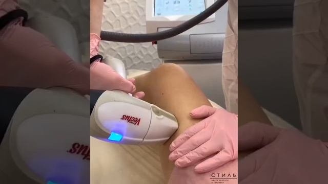 Лазерная эпиляция в Могилеве - центр красоты и здоровья Стиль