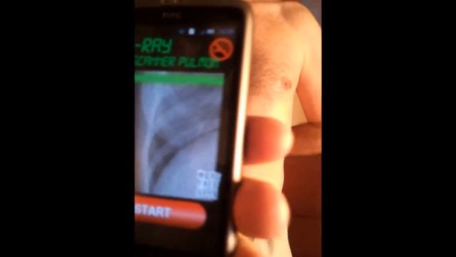 X-ray Lung Scanner - Android app from Play Store смотреть онлайн