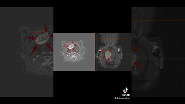 Удаление опухоли головного мозга. Доктор Вет г Минск смотреть онлайн