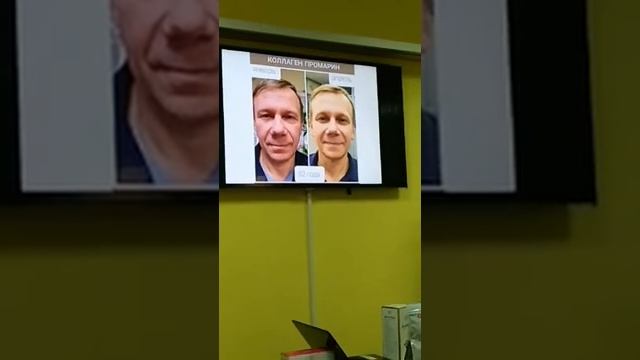 КАК ПОДДЕРЖАТЬ ХОРОШУЮ ФОРМУ ТЕЛА, ВОЛОС , НОГТЕЙ ? ОБ ЭТОМ ВРАЧ . ПЕПТИДЫ КОЛЛАГЕНА ПРОМАРИН ! ч.1 смотреть онлайн