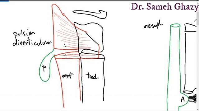 Systemic pathology 14 : GIT 1 ( oesophageal inflammation and obstruction) DR.SAMEH GHAZY смотреть онлайн