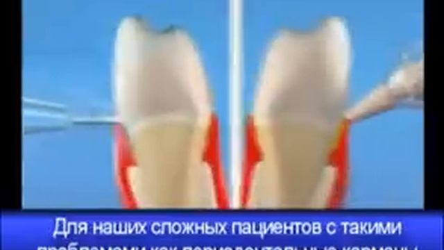 WaterPik смотреть онлайн