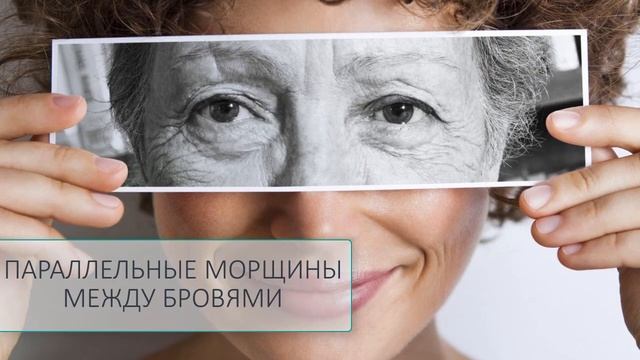 О ЧЕМ говорят морщины на лице смотреть онлайн