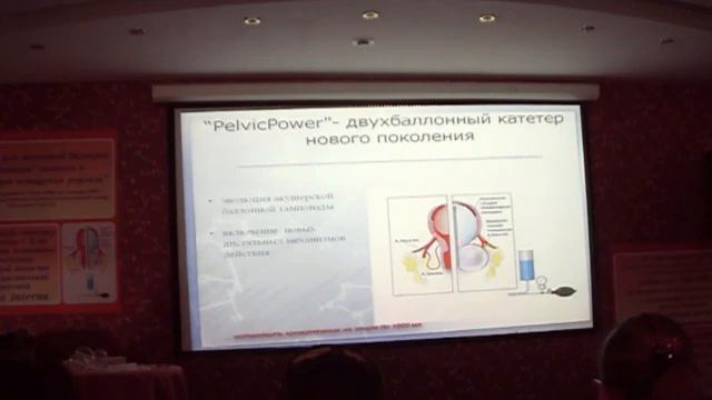 Жуковский Эволюция Баллонных катетеров часть 3 смотреть онлайн