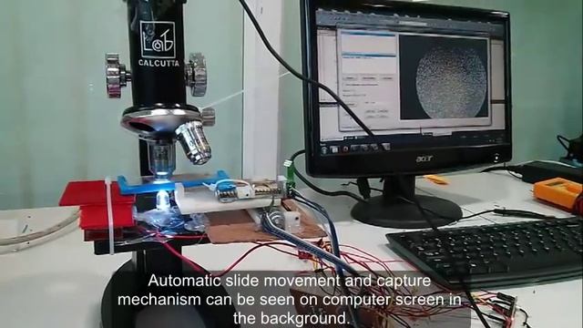 Low cost digital microscope with automated slide movement смотреть онлайн