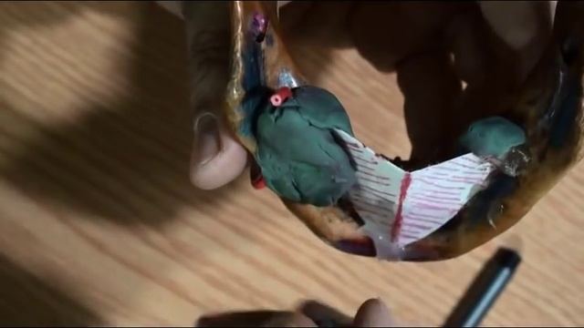 submandibular salivary gland . DR. SAMEH GHAZY смотреть онлайн