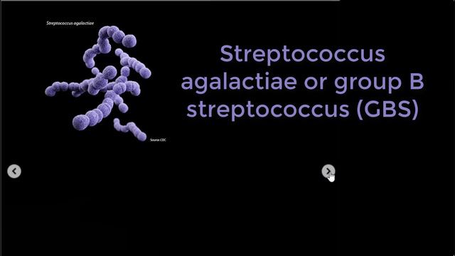 Streptococcus agalactiae or group B streptococcus (GBS) смотреть онлайн