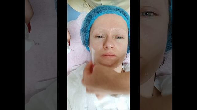 Кислотный, янтарный пилинг лица. "Аркадия" смотреть онлайн