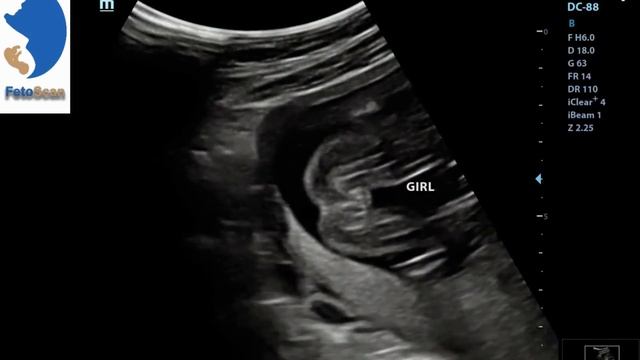Pregnancy Ultrasounds: A Journey Through the Magic of 2D смотреть онлайн