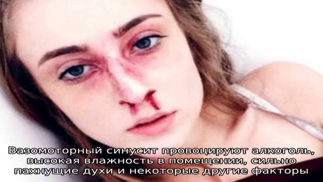 Какие виды синуситов существуют