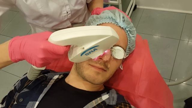 Процедура элос удаления сосудистых звездочек на носу смотреть онлайн