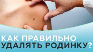 Родинки. Методы удаления родинок.