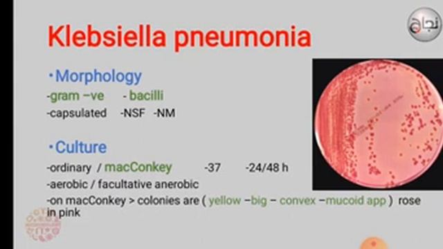 lower respiratory tract infection, Micro ,Revision смотреть онлайн