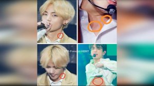 ВиГуки засосы