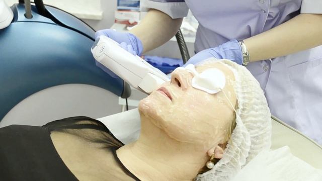 Фотоомоложение на Lumenis IPL